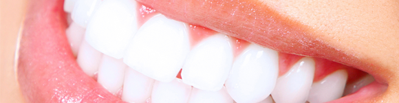 header-porcelain-veneers