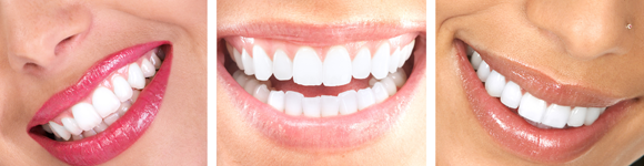 header-teeth-whitening-01