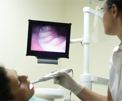 intraoral-camera