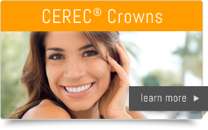CEREC® Crowns