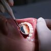 Dental Checkup