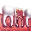 Tooth Cross Section