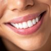 Cosmetic Dentistry Consultation